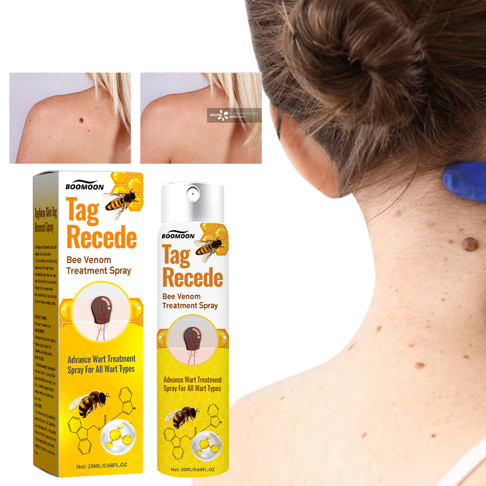 🧡 Spray Cvreoz com veneno de abelha para remover verrugas e manchas (👨‍⚕DAA RECOMENDA)🐝🐝(🔥Oferta de último dia com 50% de desconto