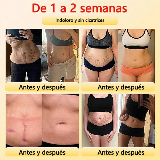 🎉 Oferta por tempo limitado – Grande desconto! 💰 Calções modeladores Anyidea™ de turmalina autorregulada com fibra de titânio