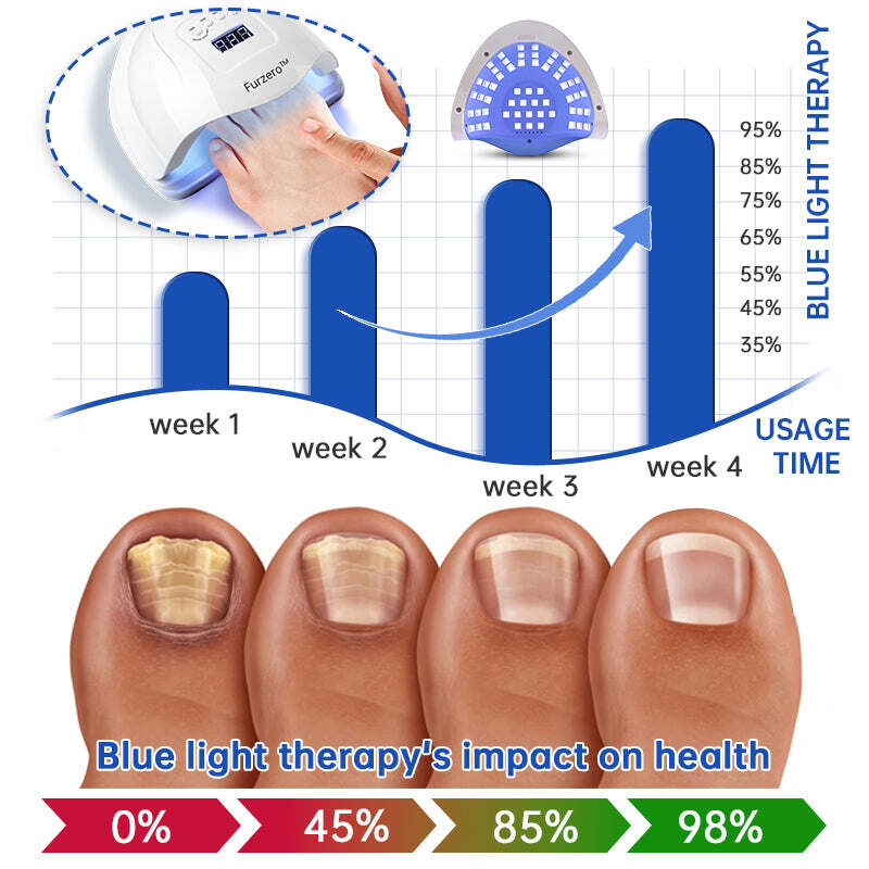 Dispositivo de tratamento laser Furzero™ PureNail para fungos