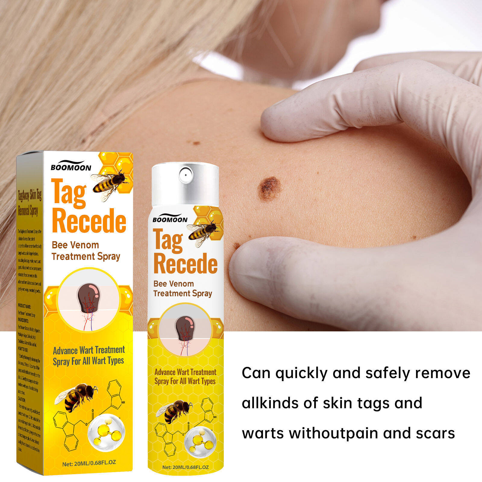 🧡 Spray Cvreoz com veneno de abelha para remover verrugas e manchas (👨‍⚕DAA RECOMENDA)🐝🐝(🔥Oferta de último dia com 50% de desconto