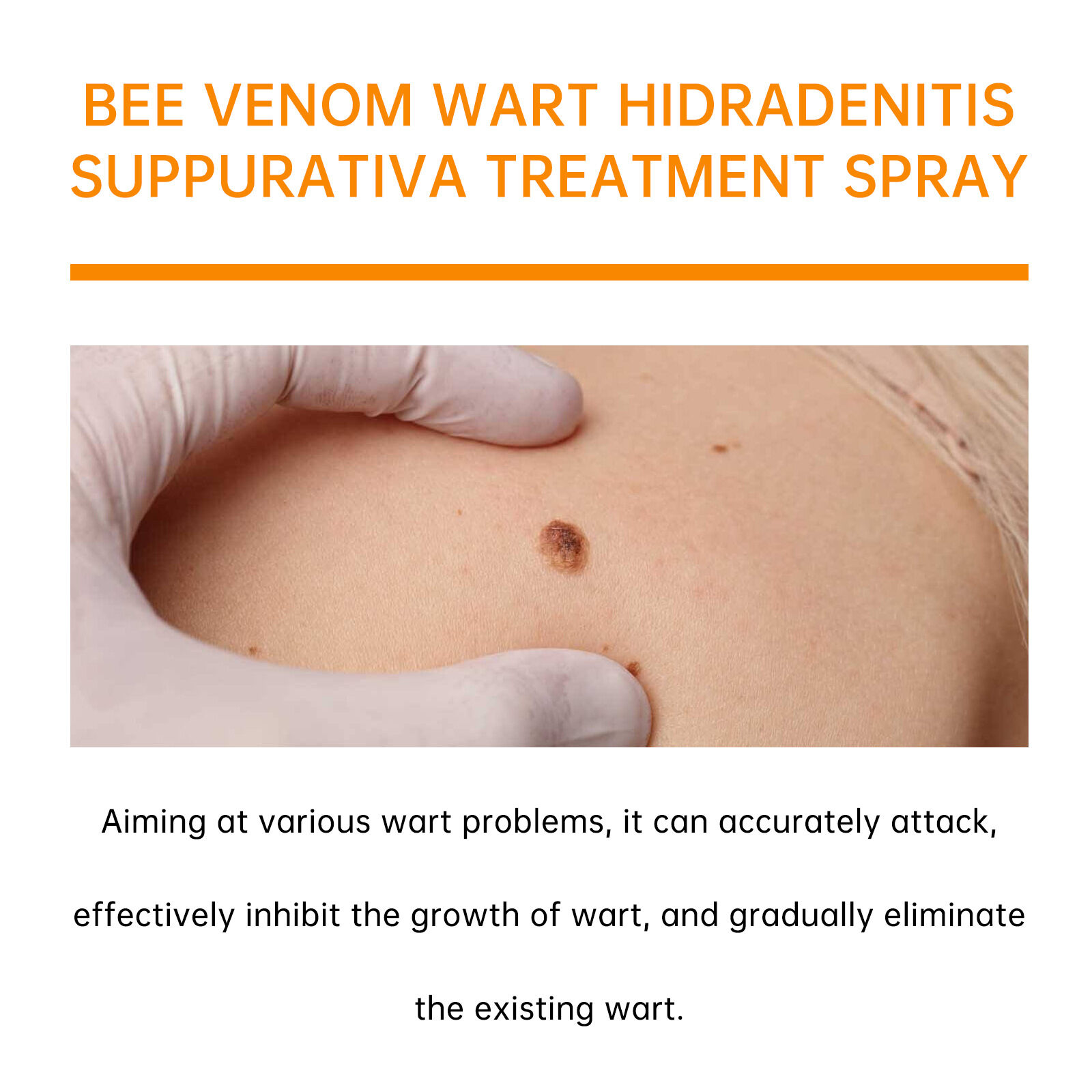 🧡 Spray Cvreoz com veneno de abelha para remover verrugas e manchas (👨‍⚕DAA RECOMENDA)🐝🐝(🔥Oferta de último dia com 50% de desconto