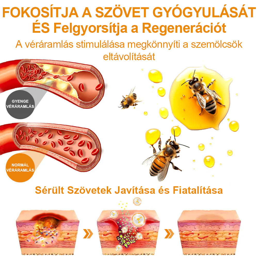 Creme para remoção de verrugas e verrugas com veneno de abelha Vsoxa™ (venda no último dia, 80% de desconto)